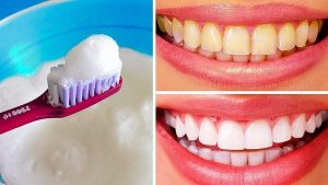 آیا سفیدکردن دندان با راهکارهای خانگی کار درستی است؟