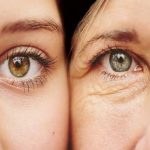 پوستی بدون چروک با ده ماده غذایی