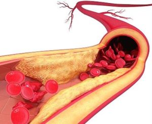 12ماده غذایی برای پیشگیری از بیماری خاموش