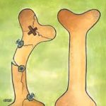 پوكي استخوان در 30 نكته
