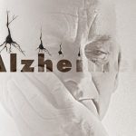 آلزايمر چيست؟