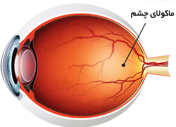 بیماری ماکولای چشمی