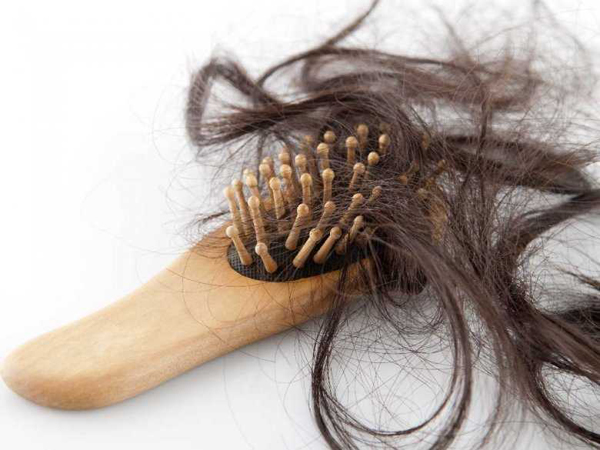 پیشگیری از ریزش موی زنان