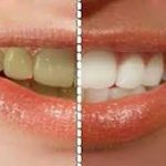 چرا رنگ دندانهاي بعضي افراد زرد است؟